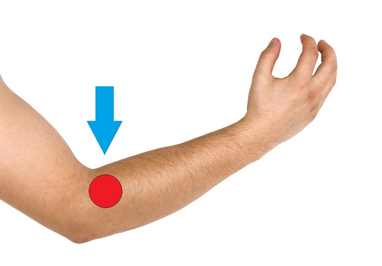 reaction spot on arm for back pain